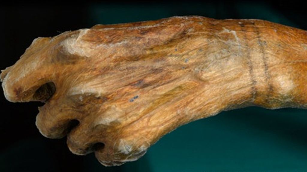Otzi