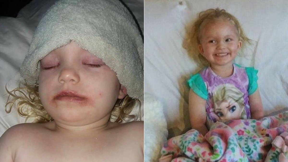 Alerta de los tóxicos en maquillajes infantiles después de que su hija sufriera una brutal reacción alérgica