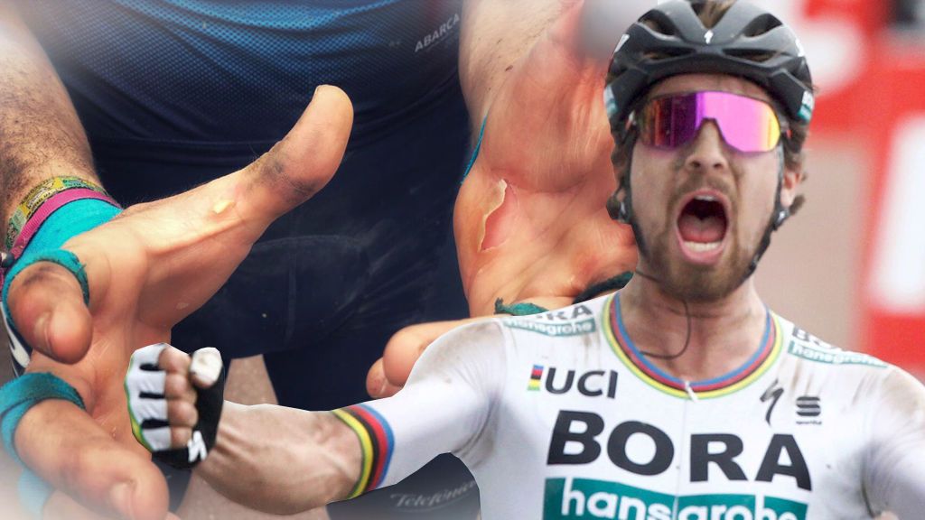 Secuelas de la París-Roubaix: el español Carlos Barbero enseña sus heridas tras atravesar 29 tramos de pavés