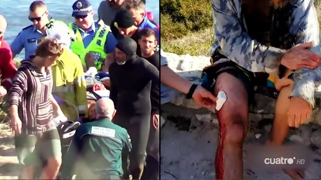 Ataques de tiburón obligan a suspender una prueba internacional de surf en Australia