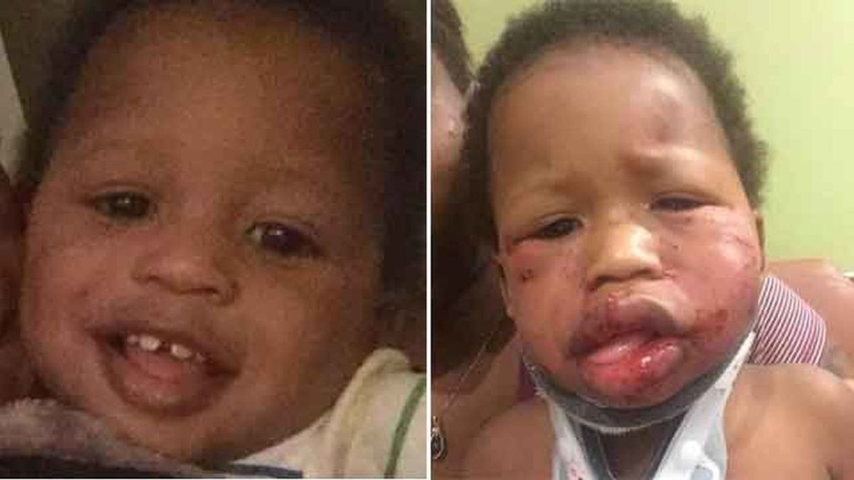 Brutal paliza a un bebé de un año en una guardería de Indiana