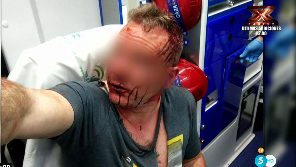 Las fotografías de las lesiones de un policía agredido en Córdoba por una familia