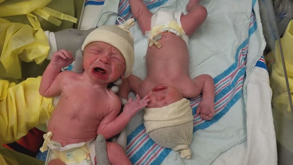 Estos gemelos recién nacidos no soportan la ausencia de su hermano