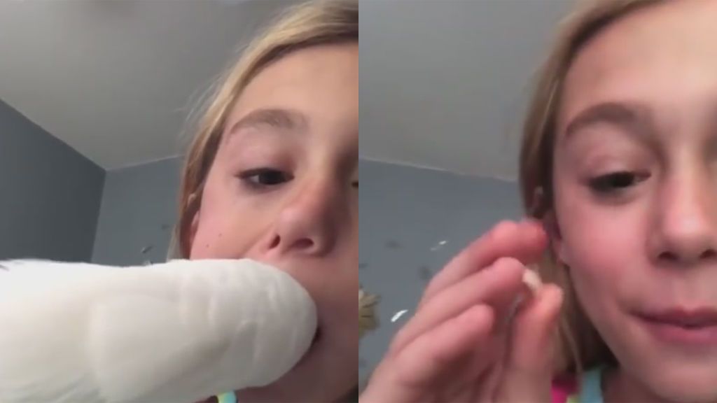 Una cacatúa ayuda a una niña a desprenderse de un diente a punto de caer