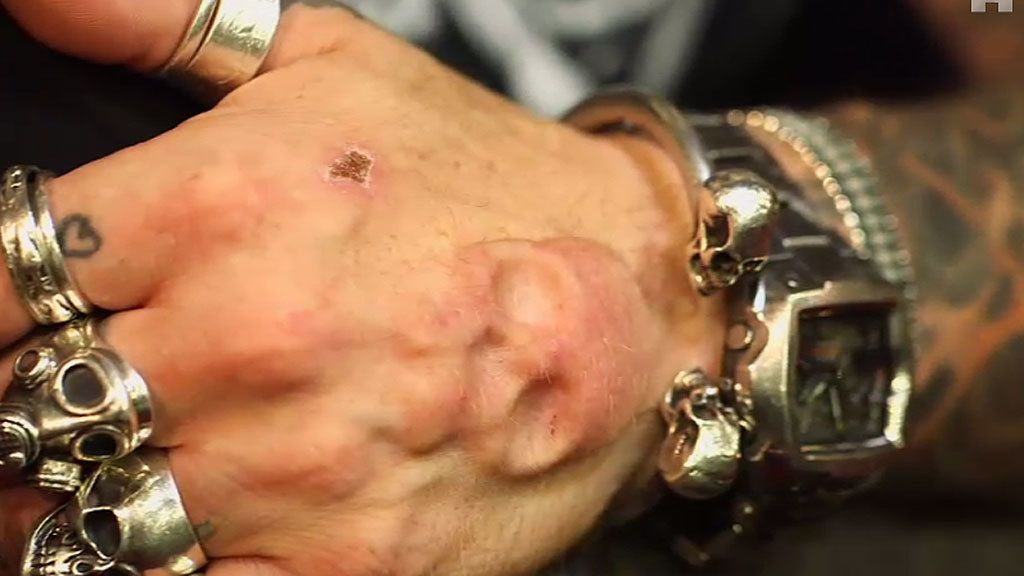 ¡Solo apto para valientes! Las modificaciones corporales más extremas de ‘Este cuerpo no es el mío