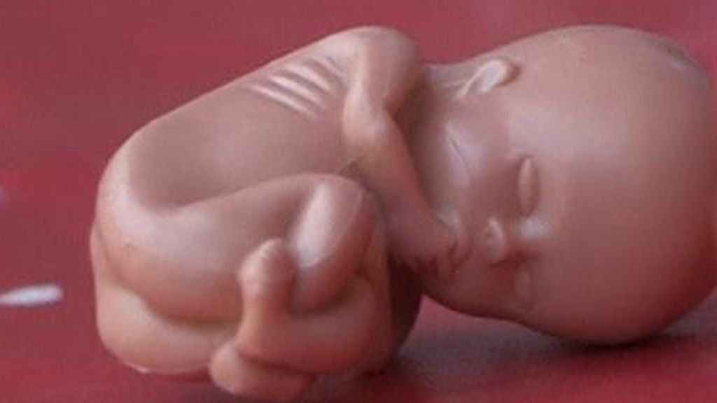 El aborto en Irlanda, pendiente de referéndum