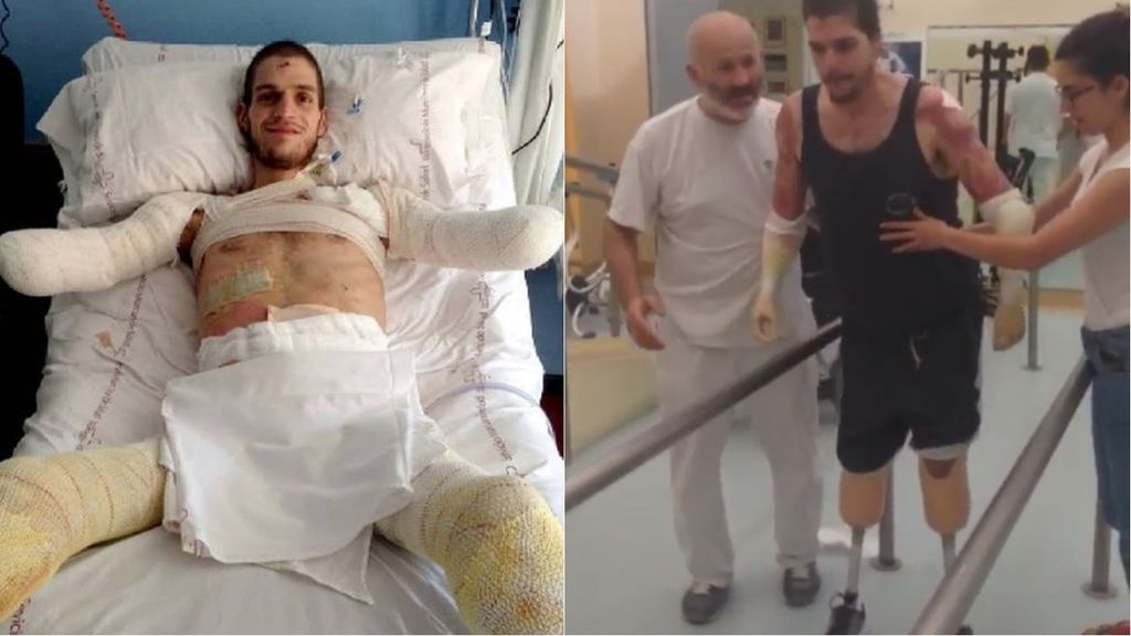 Davide, el joven que perdió sus extremidades, vuelve a caminar