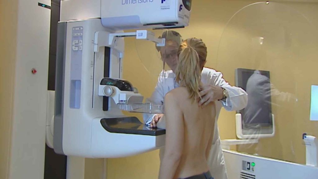 Logran evitar la quimioterapia a las mujeres con cáncer de mama con tan sólo una prueba