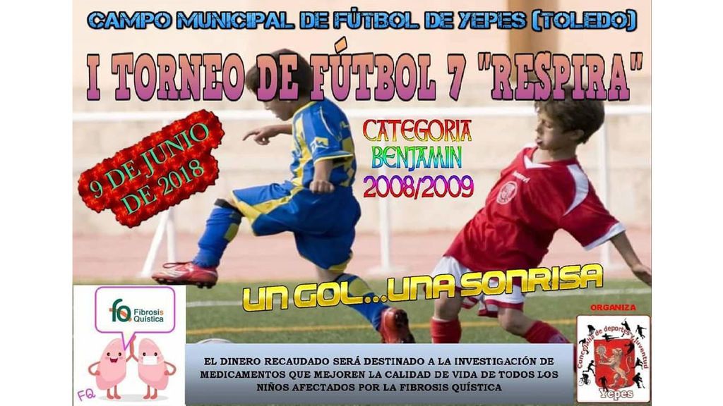 yepes