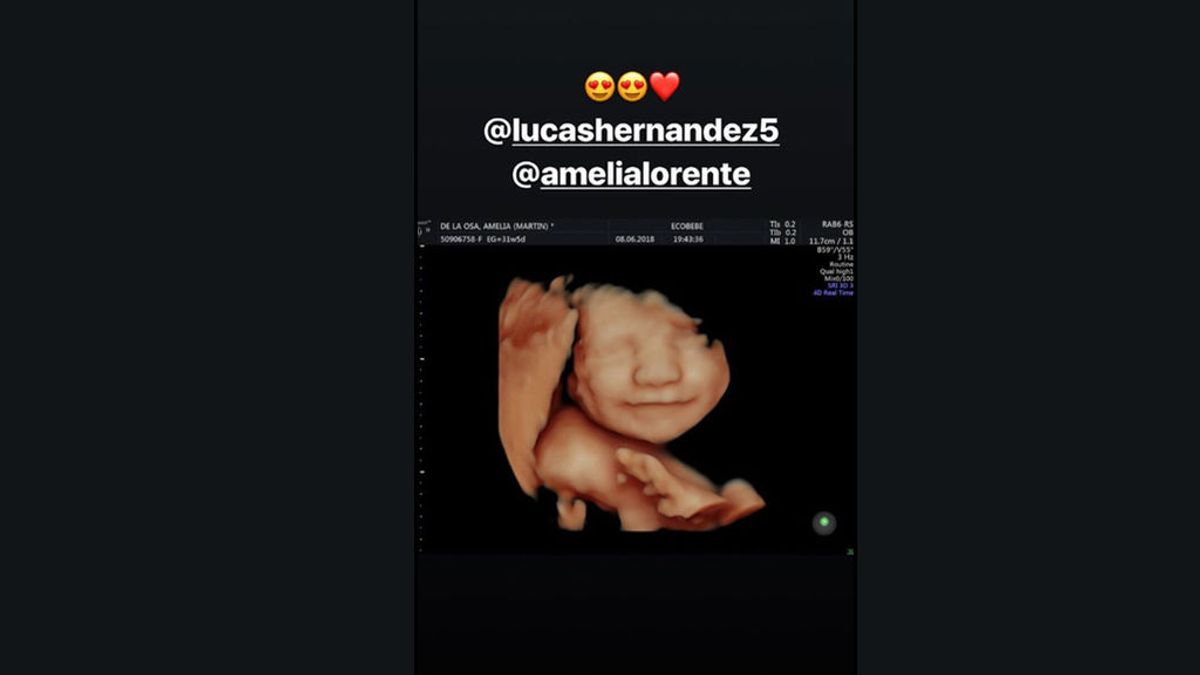 ¡Lucas Hernández va a ser padre y lo desvela su hermano Theo con una ‘story’ de Instagram!
