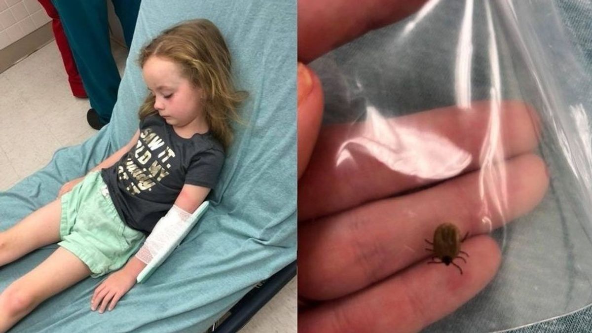 Una niña de 5 años sufre una parálisis en el cuerpo tras una picadura por garrapata
