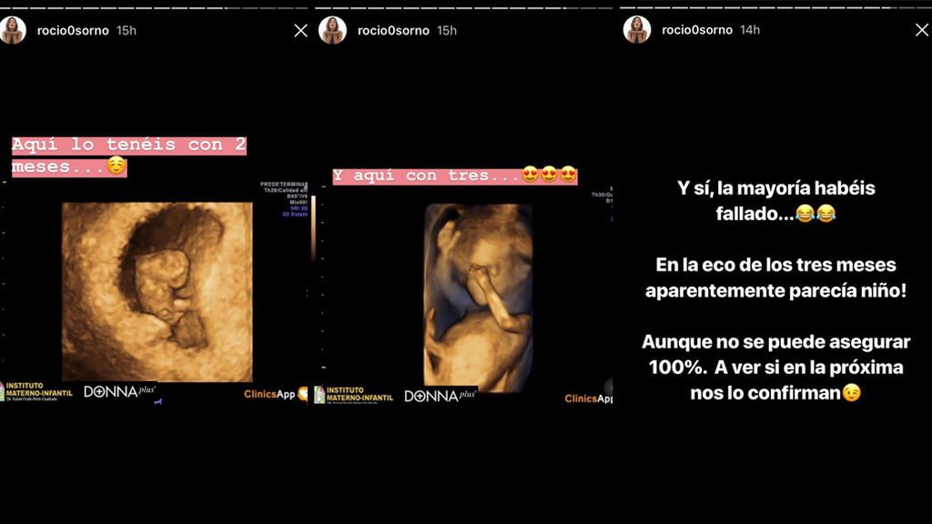 rocio osorno ecografias