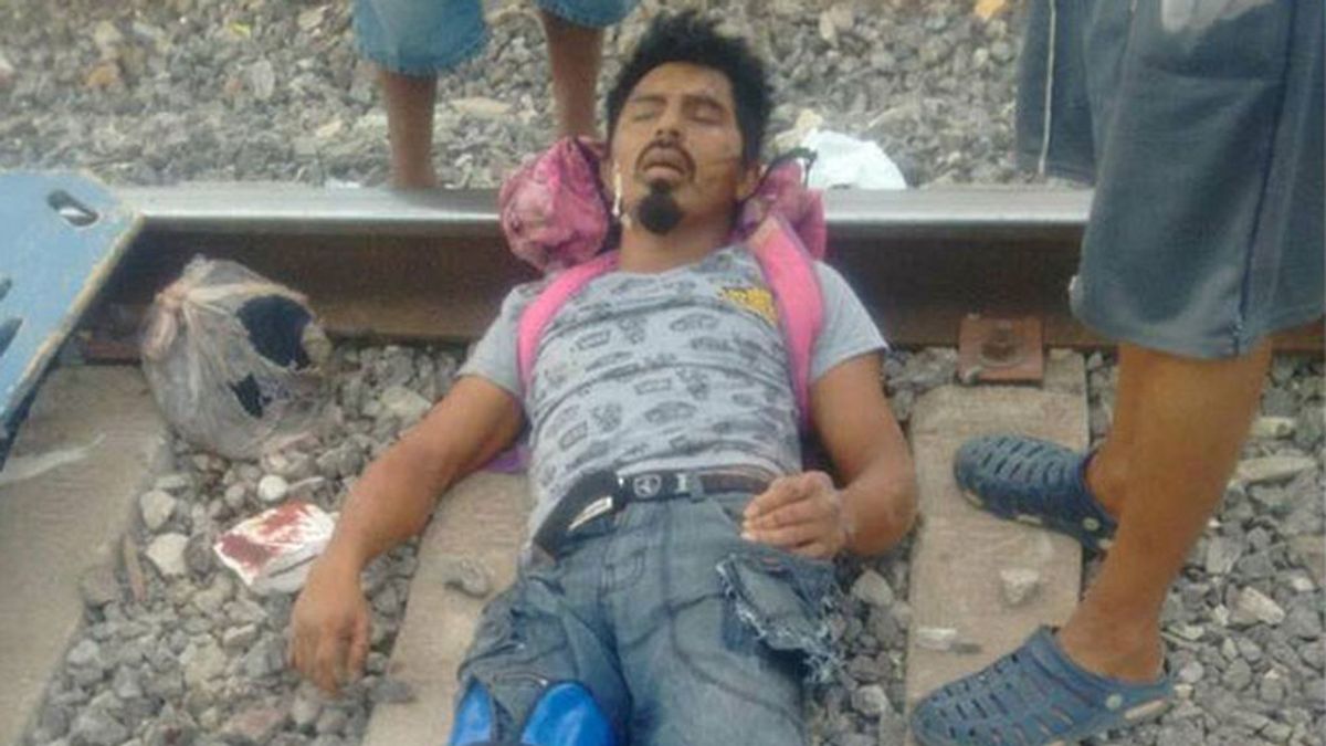 Un hombre borracho pierde un pie al quedarse dormido en las vías del tren en México
