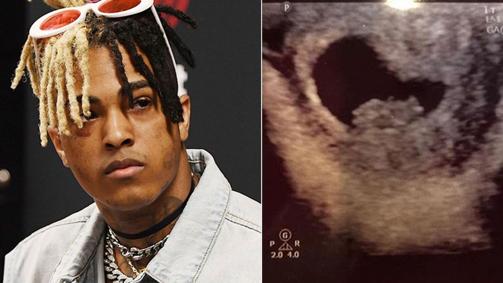 xxxtentacion-asesinato