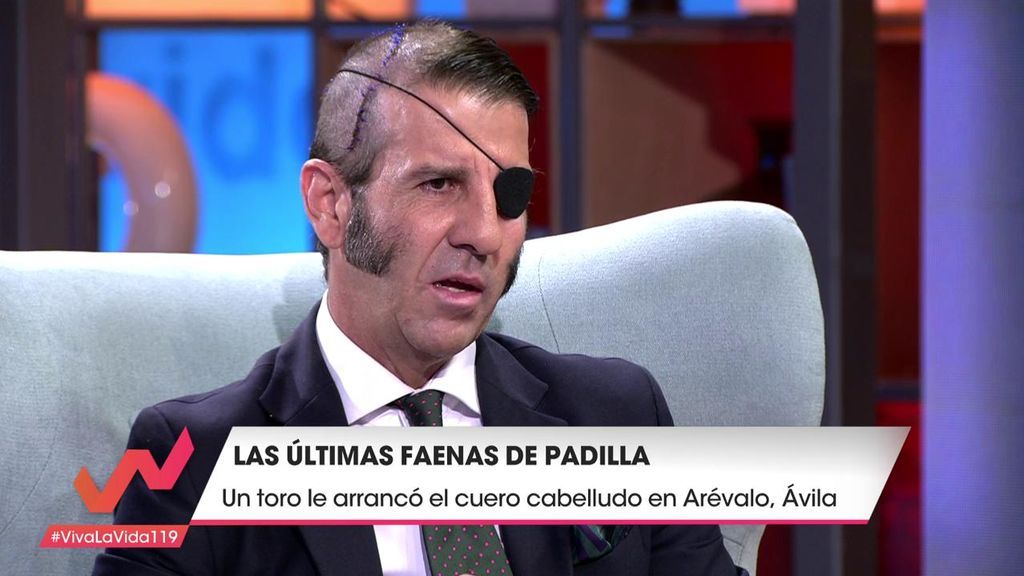 Juan José Padilla recuerda su última cornada: "Vi que llevaba el cuero cabelludo en la mano"