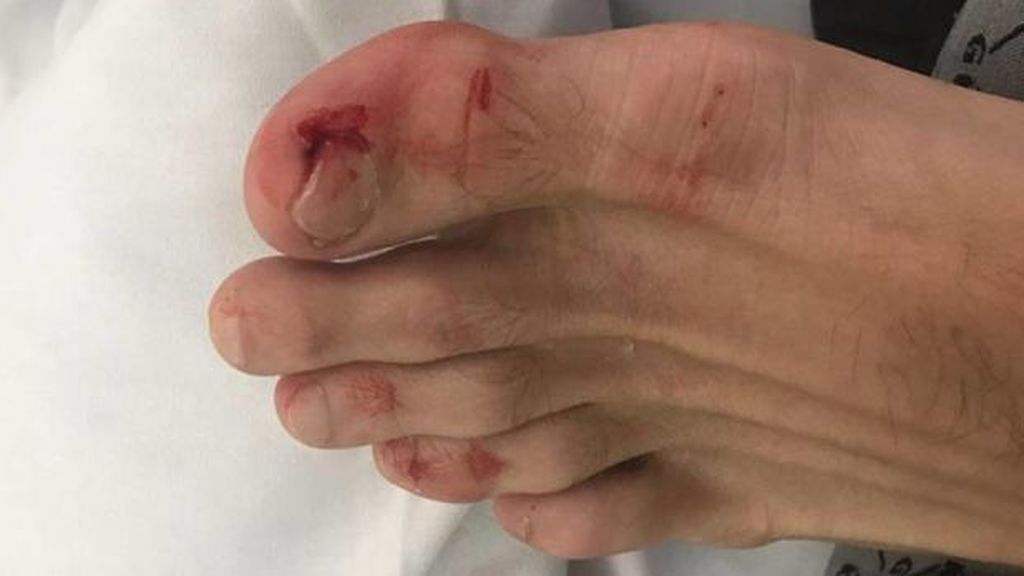 Denuncia que le pegaron mientras le operaban y los médicos le acusan de agredir a un enfermero