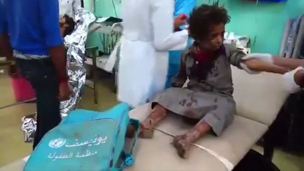 Al menos 29 niños que iban en un autobús escolar mueren en Yemen por un ataque con misil
