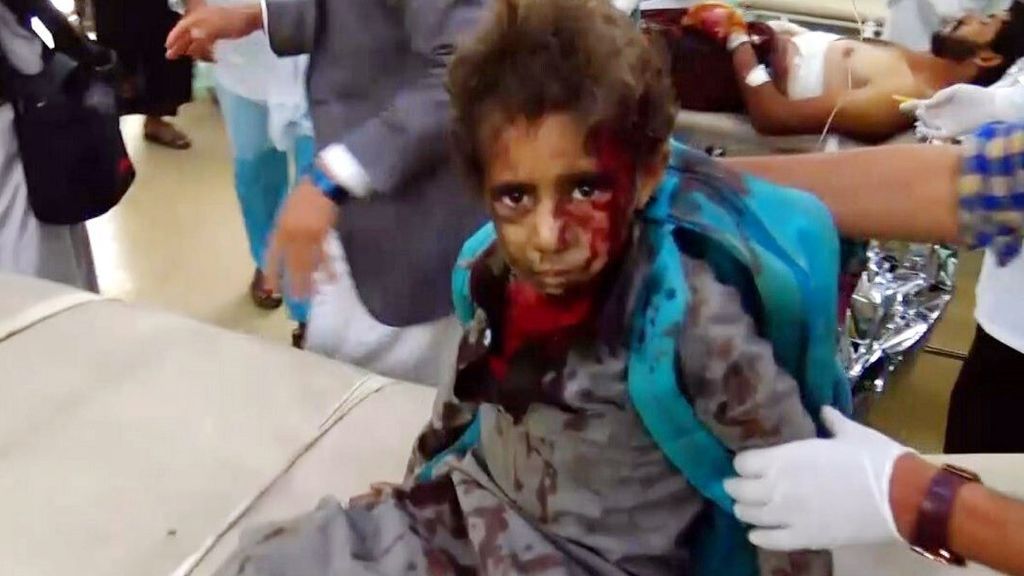 La coalición saudí mata a 30 niños en un bombardeo en Yemen