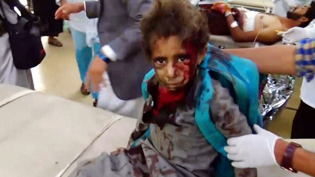 Bombardeo saudí mata a 30 niños que viajaban en un autobús en Yemen