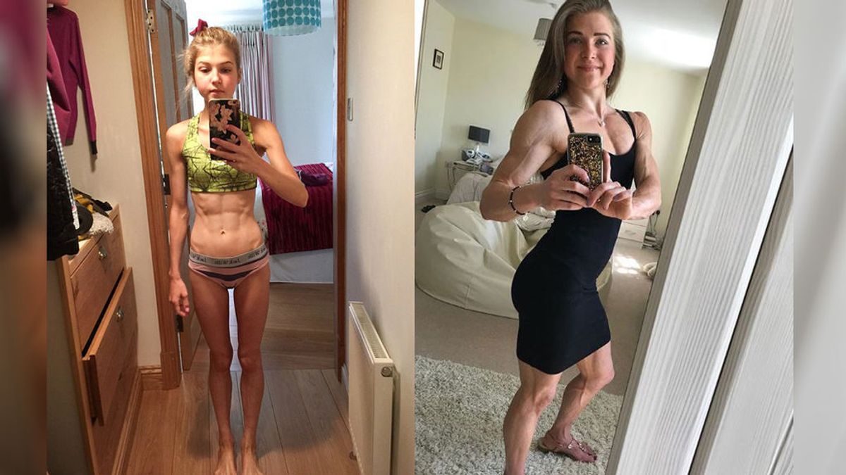 De la anorexia a campeona de de culturismo, así es la historia de esta joven inglesa