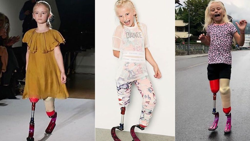 Con siete años, Daisy-May no deja que su discapacidad ponga límite a sus sueños