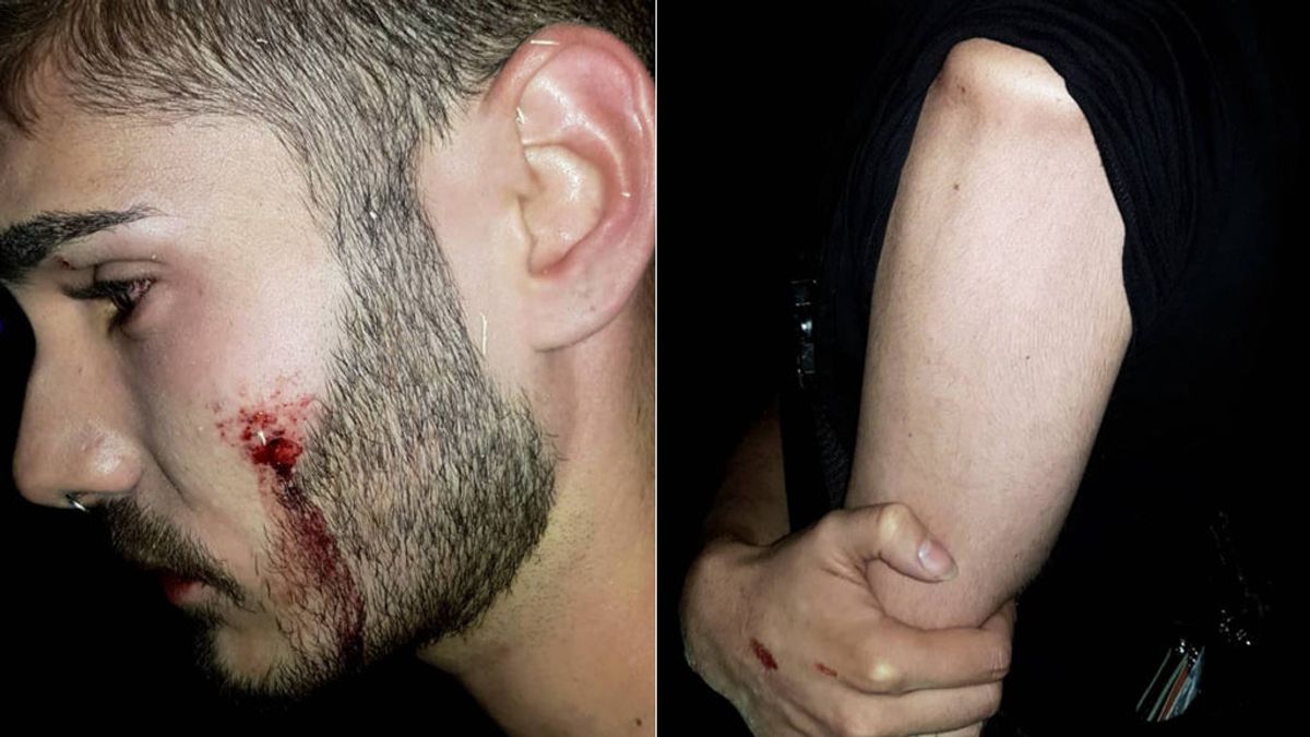 Nueva agresión homófoba a un joven en una discoteca de Alcorcón (Madrid)