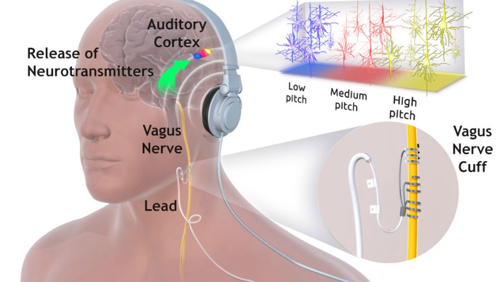 estimulador del nervio vago - ejercicios para el nervio vago