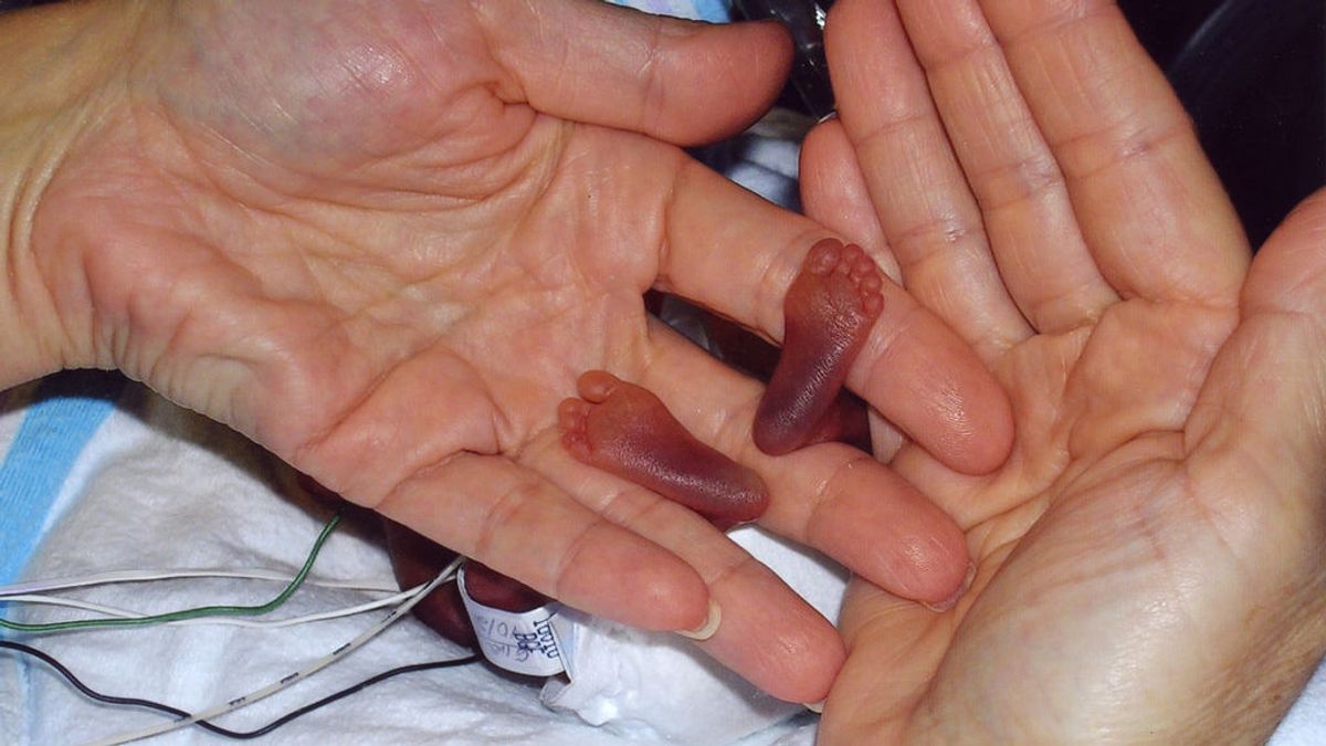 Nace un bebé con 545 gramos de peso en un hospital en Barcelona