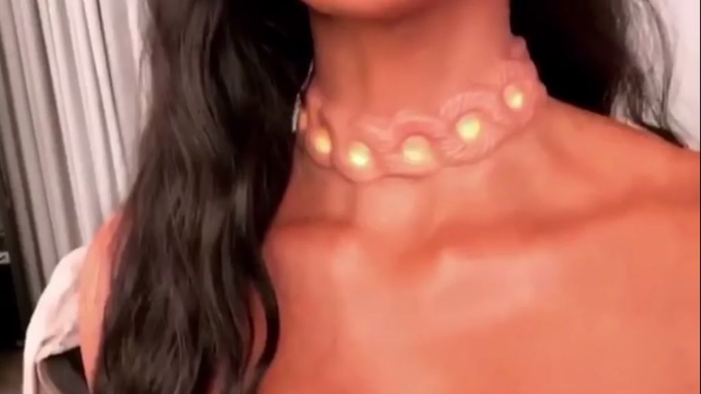 La última locura de Kim Kardashian: ¡se ha implantado un collar en el cuello!