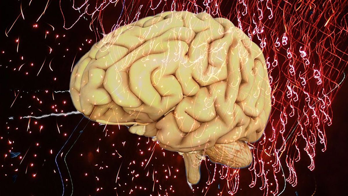 Un dispositivo implantado en el cerebro podría detener y prevenir ataques epilépticos