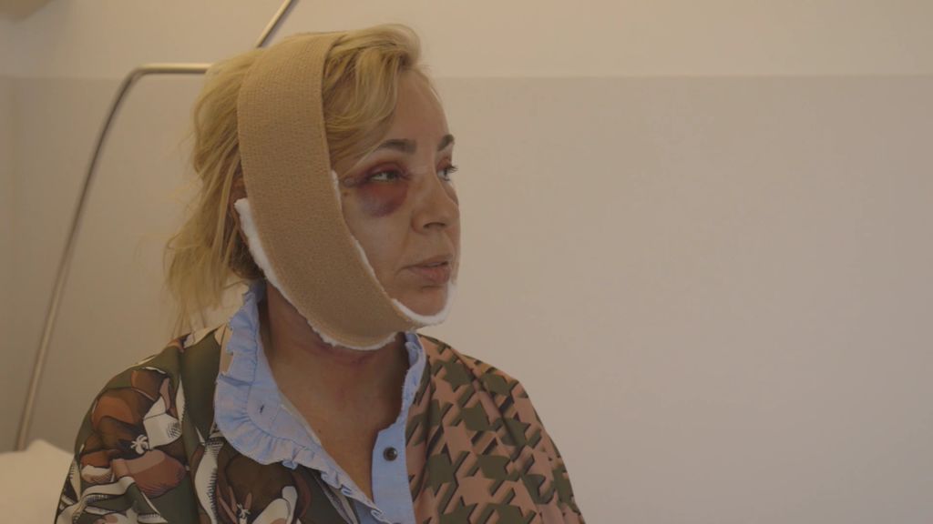 ¡Por fin! Las primeras imágenes de Carmen Borrego tras su operación de papada