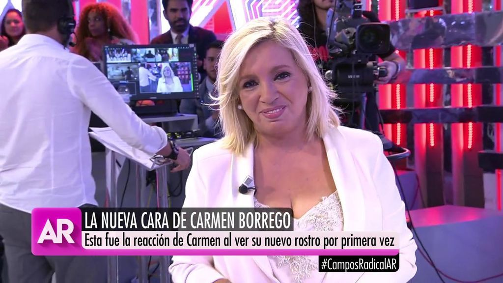Carmen Borrego se sincera con Ana Rosa sobre su operación de papada: "Tengo mucha ansiedad"