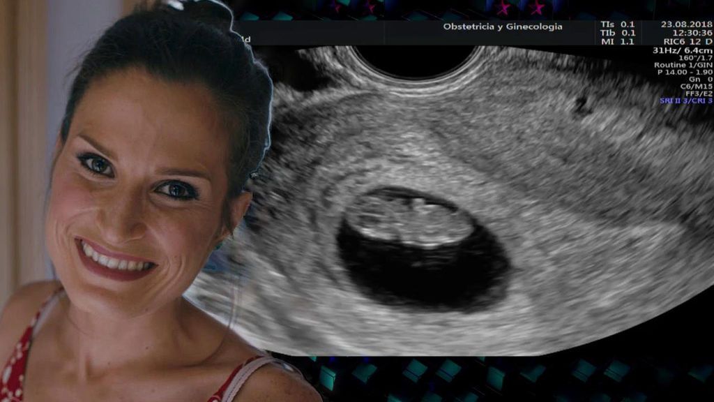 Verdeliss, la primera concursante embarazada de ‘GH VIP’, llega a Guadalix