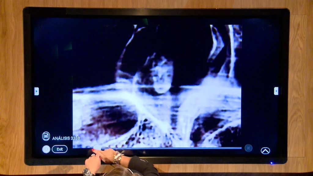 Un rostro infantil aparece en una radiografía y alerta a una espectadora