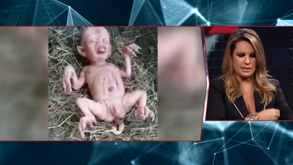 Nace un bebé con rasgos de cerdo en África y se convierte en viral... ¿o es un fake?