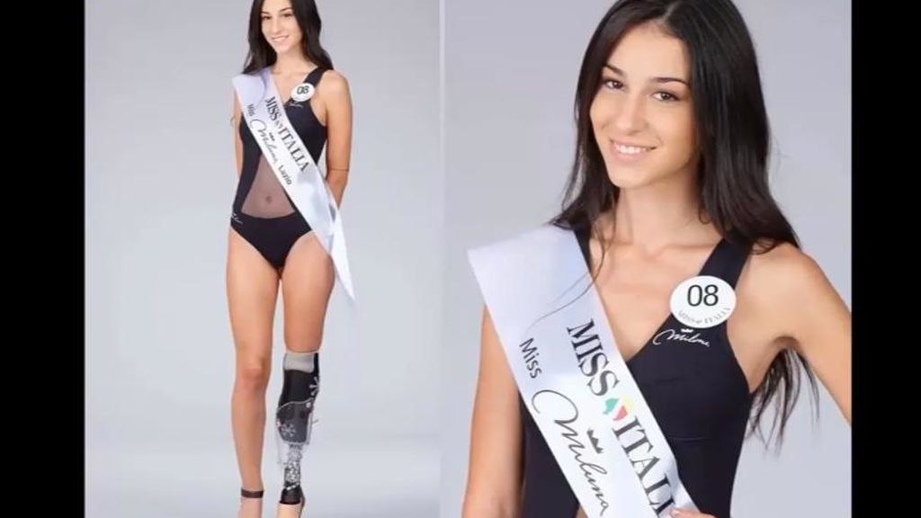 Una Miss con una pierna biónica: Chiara Bordi demuestra que la belleza no tiene límites