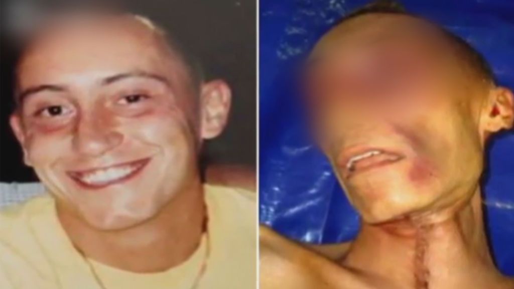 El caso de Stefano Cucchi, se reabre en ocho años después de su muerte en prisión
