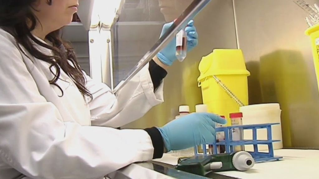 Logran acabar con el VIH de seis pacientes mediante el trasplante de células madre