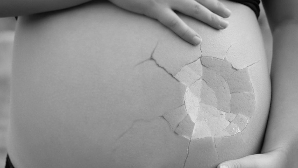 Una de cada cinco mujeres sufre problemas de salud mental durante embarazo o postparto Una de cada cinco mujeres sufre problemas de salud mental durante embarazo o postparto