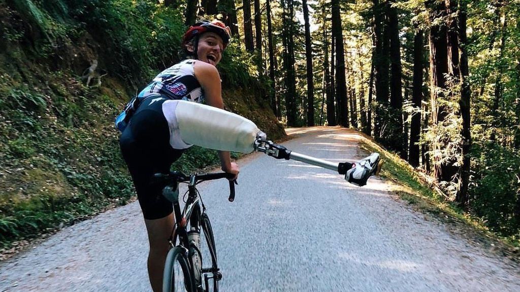 Le amputan una pierna y vuelve a subirse a una bicicleta: la historia de superación de Adrien Costa