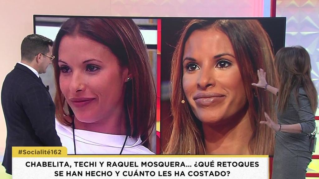 Hablamos con un experto en estética sobre los retoques de Techi