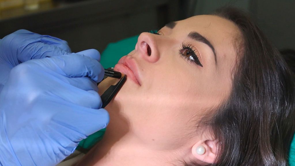 Ruth, tras pasar por quirófano para ponerse labios: "Me ha quedado muy natural" (1/2)