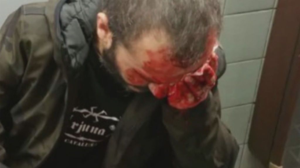 Herido un manifestante de Jusapol en la marcha en Barcelona