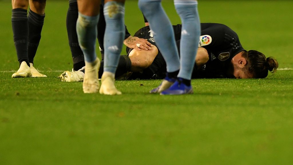 El Real Madrid se quejó de la dureza del Celta al que se le acusa de jugar al límite del reglamento