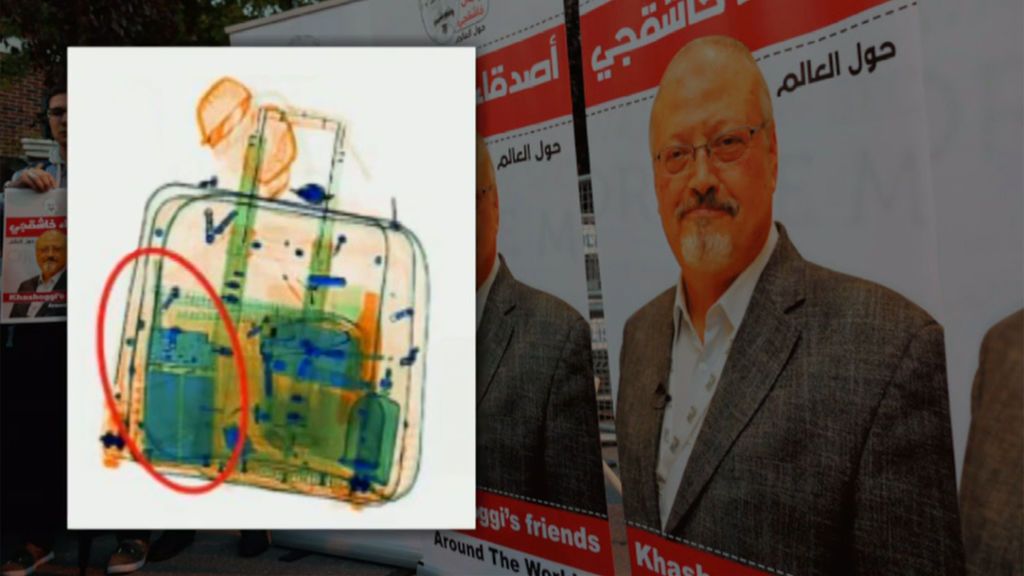 Las maletas de los sospechosos del asesinato de Khashoggi contenían tijeras, jeringuillas y desfibriladores