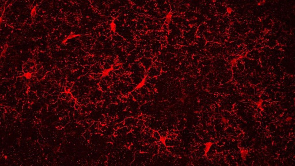 Antiinflamatorios para mejorar los problemas cognitivos por la abstinencia de la nicotina Antiinflamatorios para mejorar los problemas cognitivos por la abstinencia de la nicotina