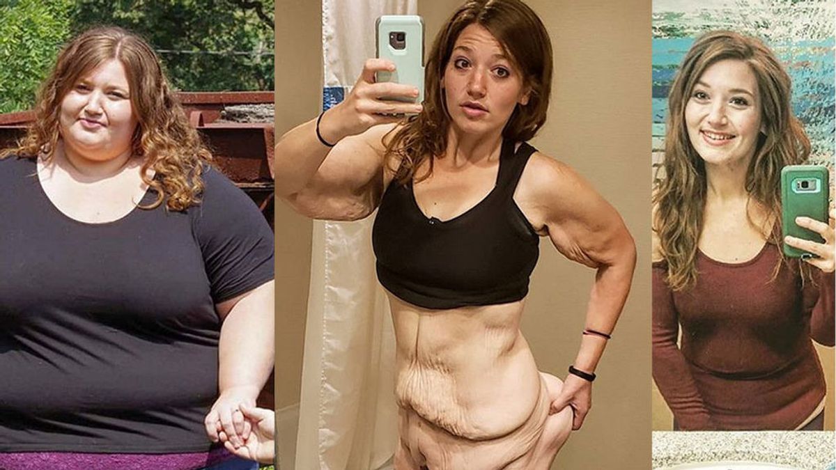 Muestra en Instagram cómo perdió 140 kilos en dos años y 3 kilos de exceso de piel