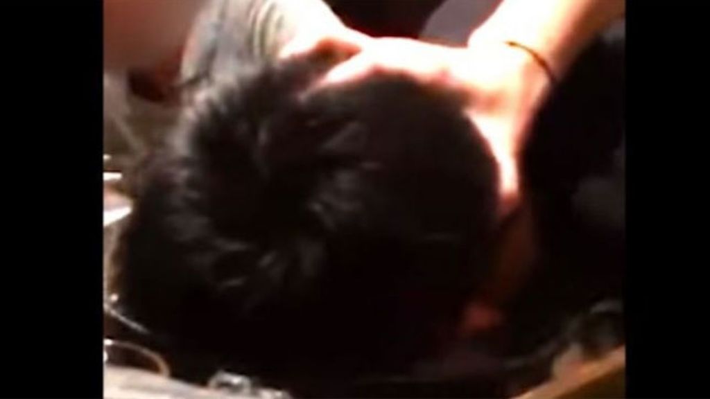 Un jefe mete la cara de su empleado en una olla hirviendo y le deja graves secuelas Un jefe mete la cara de su empleado en una olla hirviendo y le deja graves secuelas