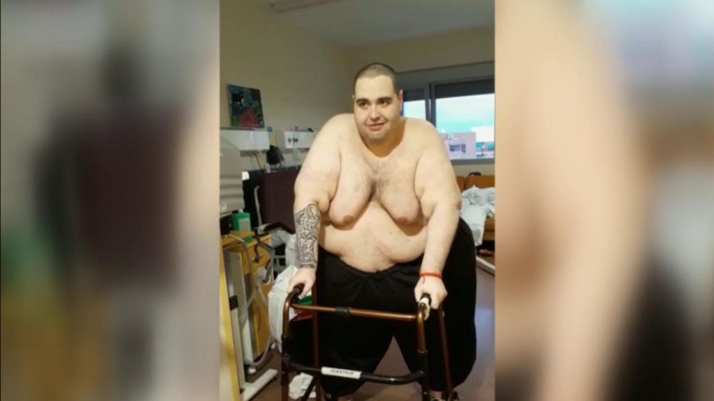 Teófilo Rodríguez, el joven con obesidad mórbida extrema, pierde 95 kilos en tres meses