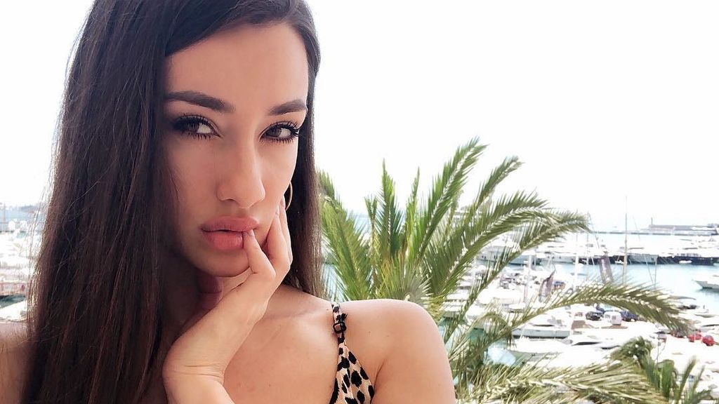 Adara rebusca en el pasado para reírse de las críticas: "Cuando me empecé a poner labios"